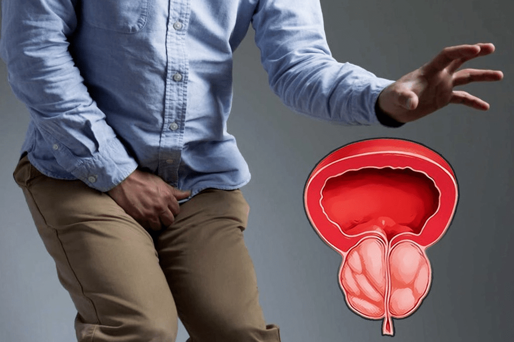 Prostatitis a seng Behandlung mat Weiprost Kapselen